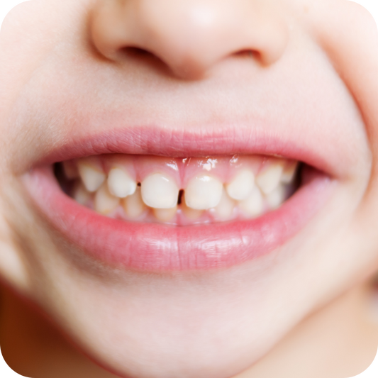 What is Saliva and How Does it Impact Oral Health?