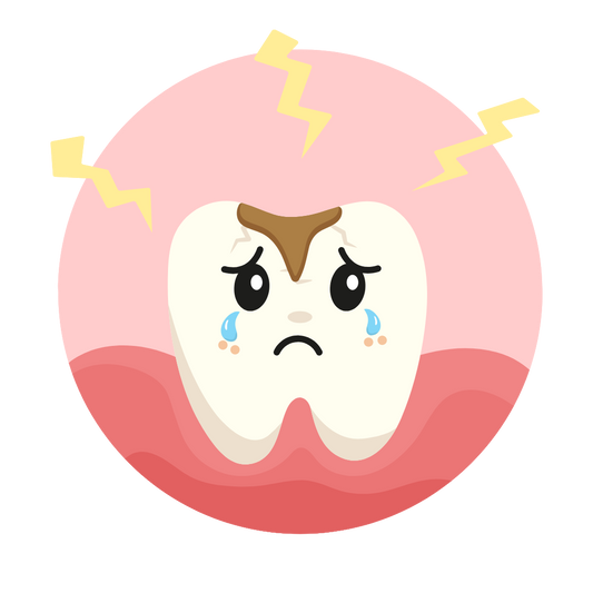 What are cavities? A Kid-Friendly Answer