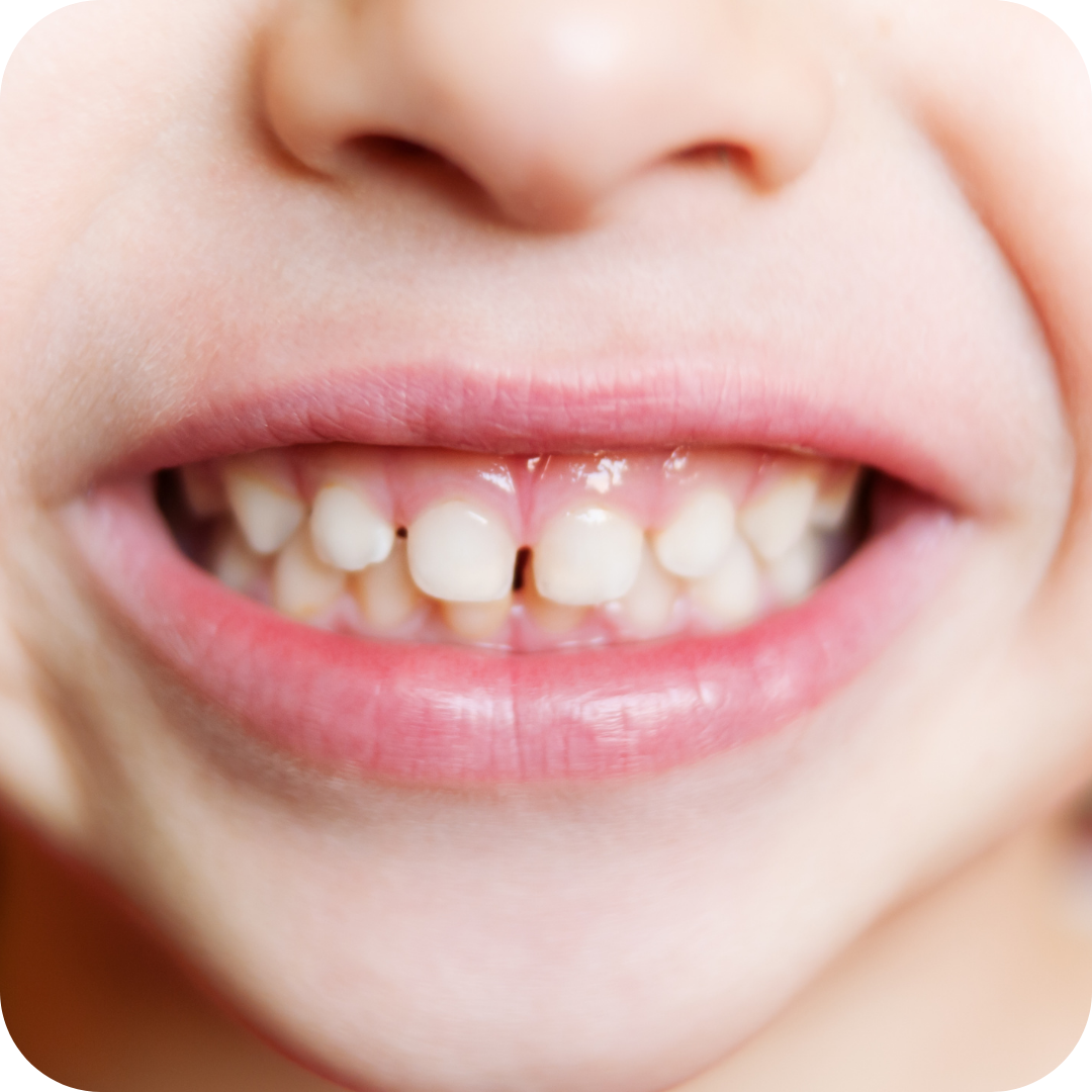 What is Saliva and How Does it Impact Oral Health?