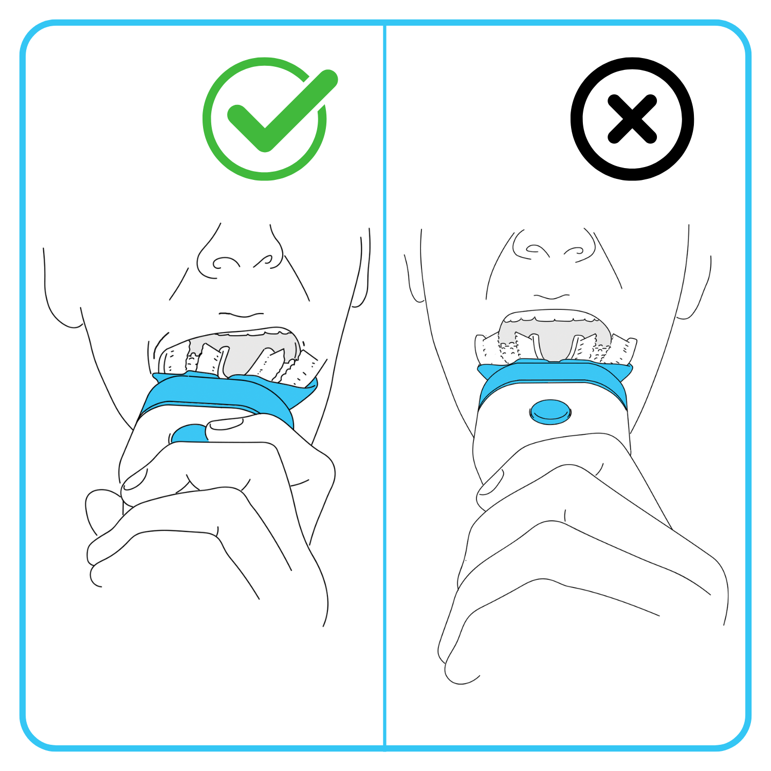 Close up showing how to insert Willo into mouth correctly by putting in one side at a time