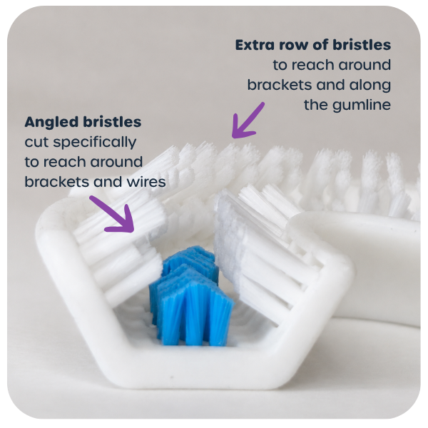 Macro close-up diagram of a white U-shaped toothbrush head highlighting two key bristle design features: "Angled bristles cut specifically to reach around brackets and wires" pointing to white side bristles, and "Extra row of bristles to reach around brackets and along the gumline" pointing to top outer bristles.